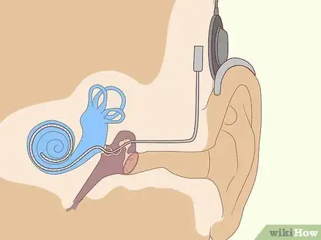 Imagen titulada Improve Your Hearing Step 4