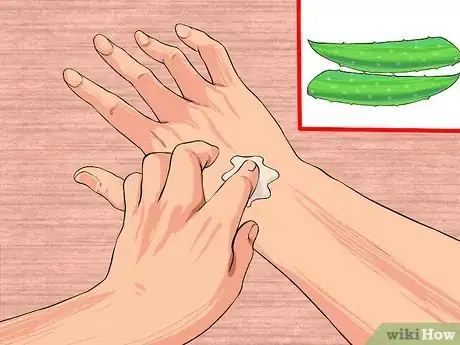 Imagen titulada Grow and Use Aloe Vera for Medicinal Purposes Step 8