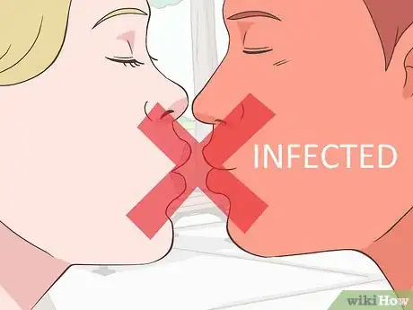 Imagen titulada Prevent a Cold Sore from Forming Step 1