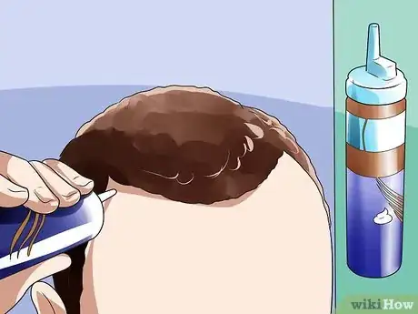 Imagen titulada Treat Male Pattern Hair Loss Step 2