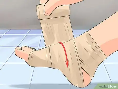 Imagen titulada Treat Neuropathy in Feet Step 13