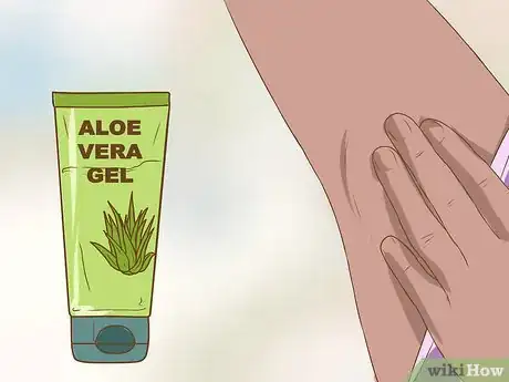 Imagen titulada Get Rid of a Zit on Your Armpit Step 9