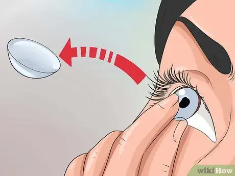 Imagen titulada Get Rid of Pink Eye Fast Step 7