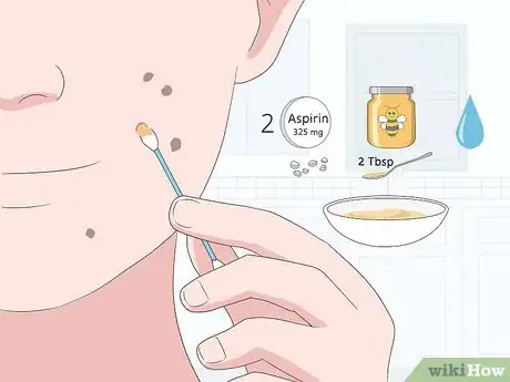 Imagen titulada Get Rid of Dark Spots from Acne Step 4