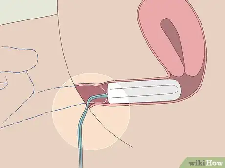 Imagen titulada Insert a Tampon Without Applicator Step 9