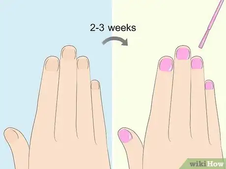 Imagen titulada Heal Damaged Nails Step 6