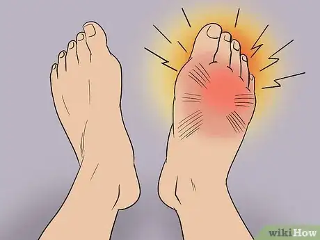 Imagen titulada Treat Pain at the Top of the Foot Step 5