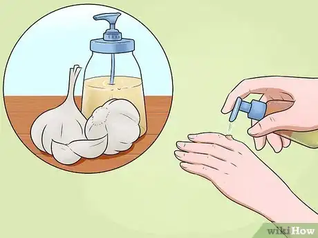 Imagen titulada Get Rid of Warts on Hands Step 7