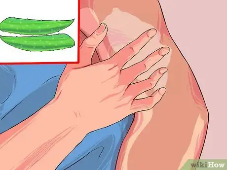 Imagen titulada Grow and Use Aloe Vera for Medicinal Purposes Step 7