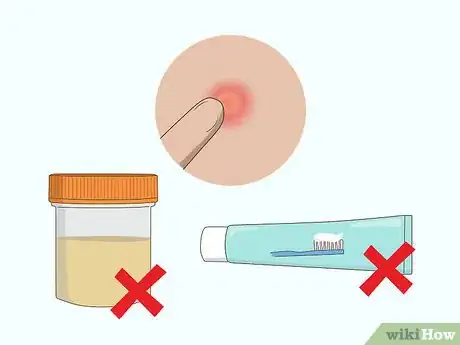 Imagen titulada Shrink Pimples Step 6