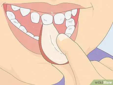 Imagen titulada Pull a Loose Tooth at Home Step 2