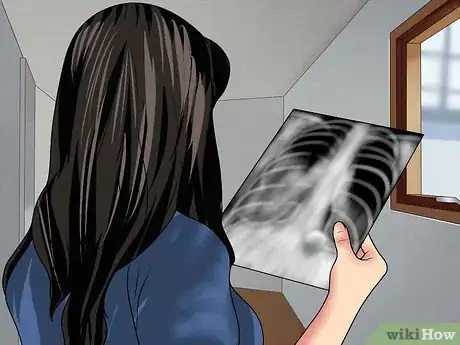 Imagen titulada Read a Chest X Ray Step 12