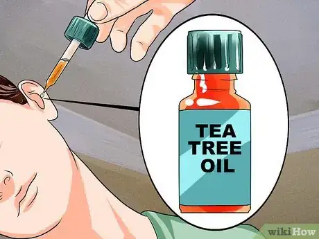 Imagen titulada Treat Ear Aches With Natural Remedies Step 18