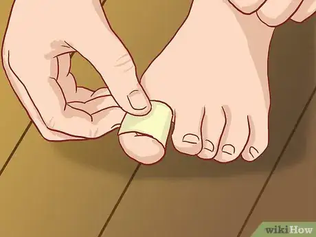 Imagen titulada Straighten Toes Step 8