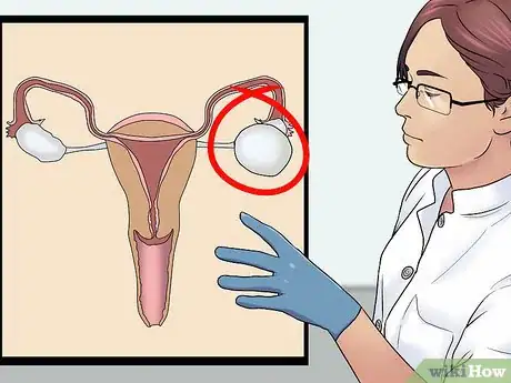 Imagen titulada Know if You Have an Ovarian Cyst Step 10