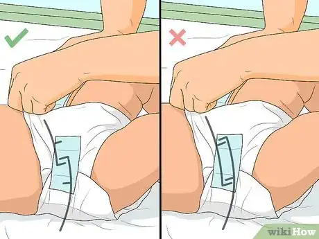 Imagen titulada Relieve Diaper Rash Fast Step 19