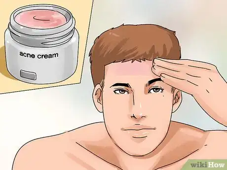 Imagen titulada Remove a Blackhead from Your Forehead Step 10