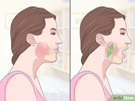 Imagen titulada Treat Temporomandibular Joint Disorder (TMD) with Jaw Exercises Step 5