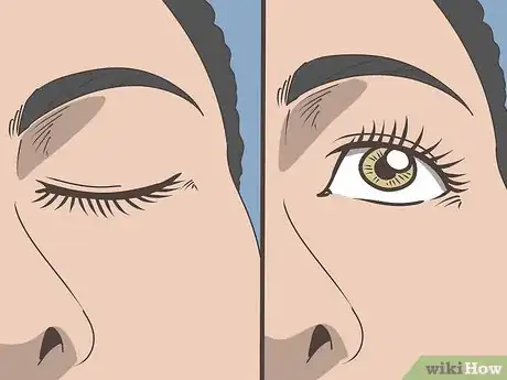 Imagen titulada Wash Eyes With Water Step 25