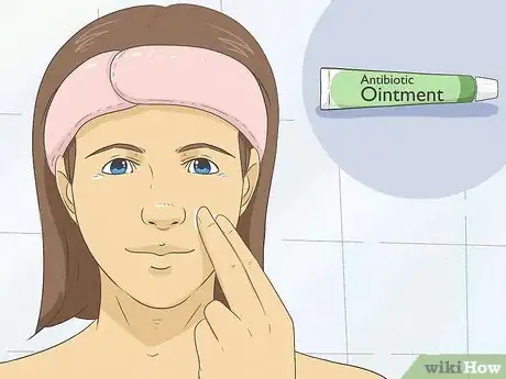 Imagen titulada Heal Your Face After Picking Step 3