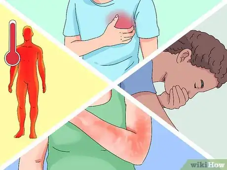 Imagen titulada Treat a Severe Sunburn Step 13