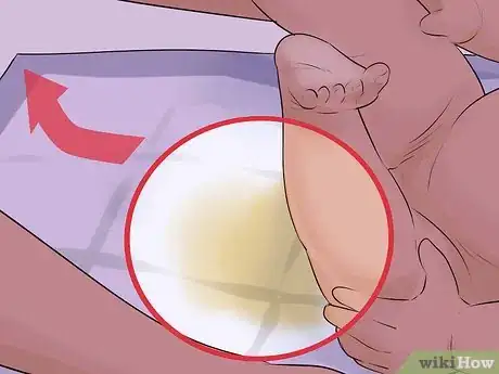 Imagen titulada Help a Male Child Provide a Urine Sample Step 32