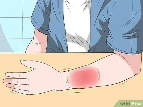 Imagen titulada Make a Sling for Your Arm Step 16