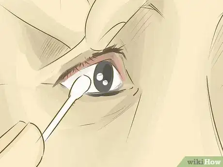 Imagen titulada Remove Something from Your Eye Step 6