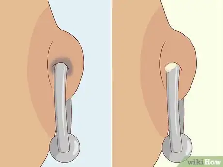 Imagen titulada Care for a Nipple Piercing Step 4