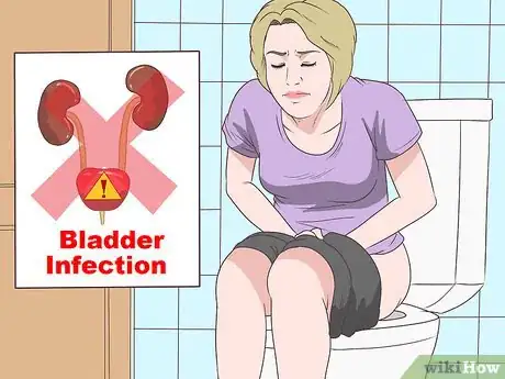 Imagen titulada Treat a Urinary Tract Infection Step 11