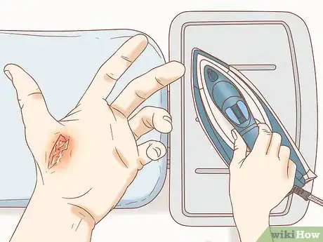 Imagen titulada Treat a Burn from an Iron Step 1