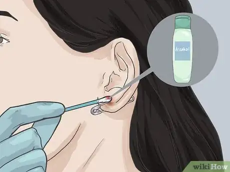 Imagen titulada Pierce Your Ear with a Safety Pin Step 9