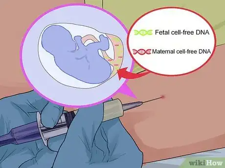 Imagen titulada Test for Down Syndrome Step 4