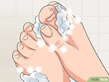 Imagen titulada Remove a Dead Toenail Step 7