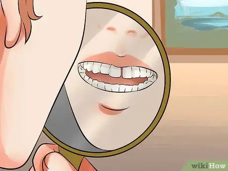 Imagen titulada Get Rid of Gaps in Teeth Step 2