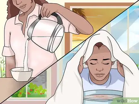 Imagen titulada Get Rid of Blackheads When Your Skin is Sensitive Step 4