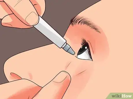 Imagen titulada Use Erythromycin Eye Ointment Step 11