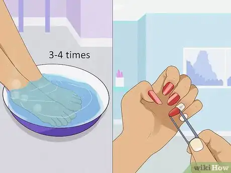 Imagen titulada Stop Itchy Cuticles Step 5