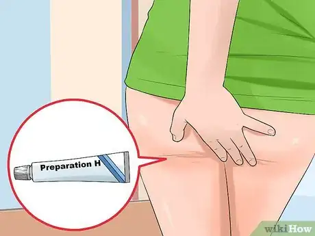 Imagen titulada Stop Hemorrhoids from Itching Step 4