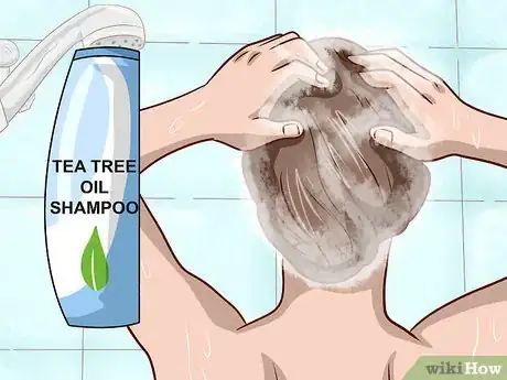 Imagen titulada Stop Scalp Picking Step 10