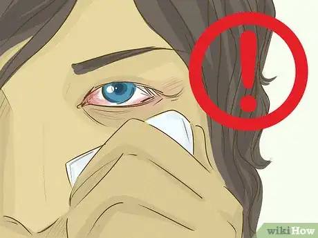 Imagen titulada Remove Something from Your Eye Step 9