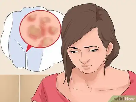 Imagen titulada Treat Genital Warts in Women Step 1