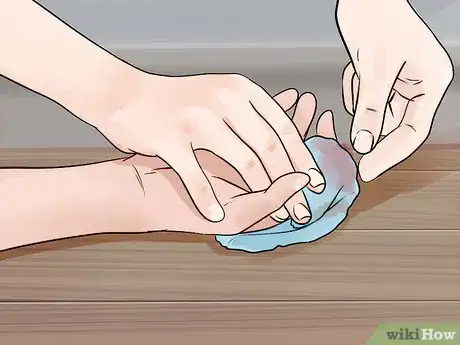 Imagen titulada Give First Aid for a Severed Finger Step 8