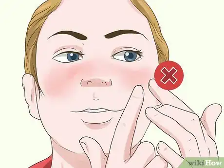 Imagen titulada Reduce the Redness of Sunburn Step 16