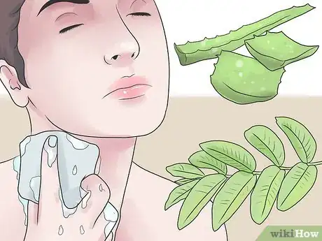 Imagen titulada Treat an Infected Sebaceous Cyst Step 14