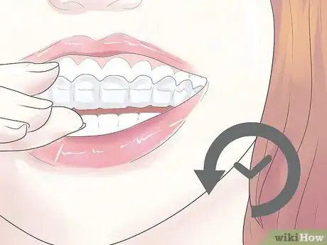 Imagen titulada Cope with Teeth Whitening Sensitivity Step 7