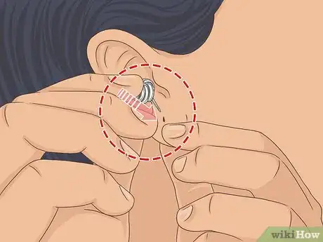 Imagen titulada Put Your Earring Back when It Won't Go in Step 7