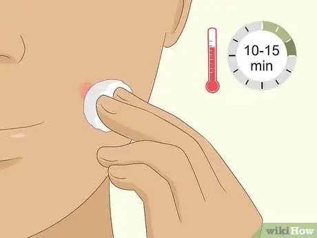 Imagen titulada Instantly Get Rid of a Pimple (Cotton Ball Popping Method) Step 1