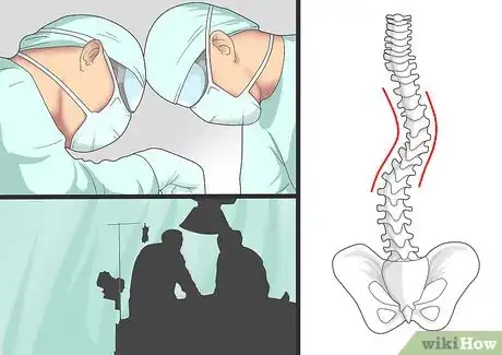 Imagen titulada Relieve Back Pain from Scoliosis Step 12