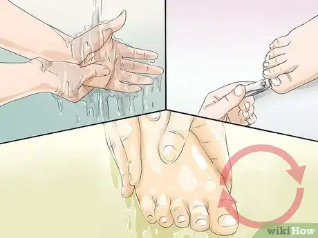 Imagen titulada Prevent the Spread of Fungal Infections Step 14